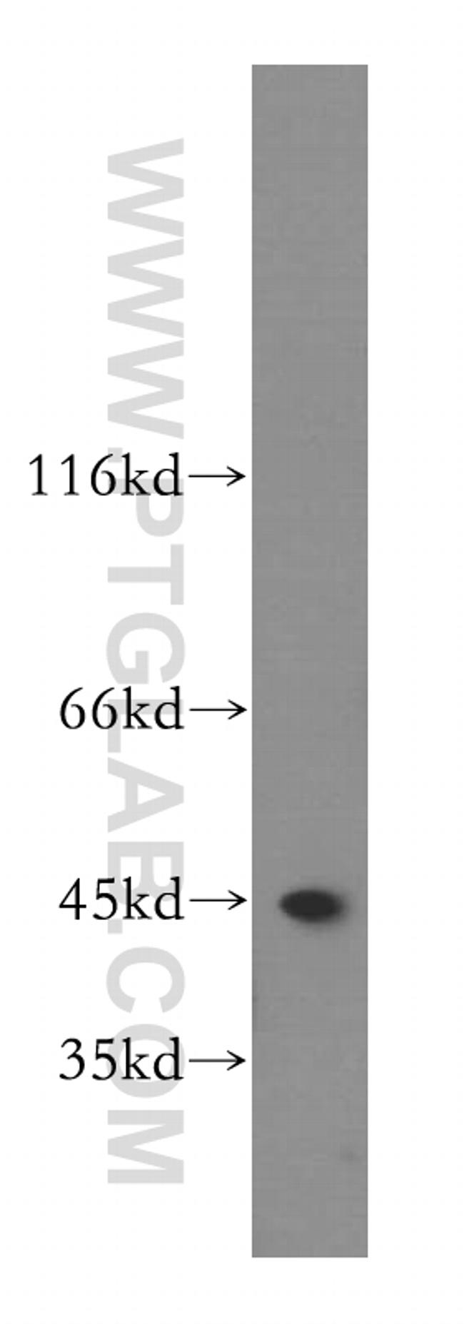 FAH Antibody in Western Blot (WB)