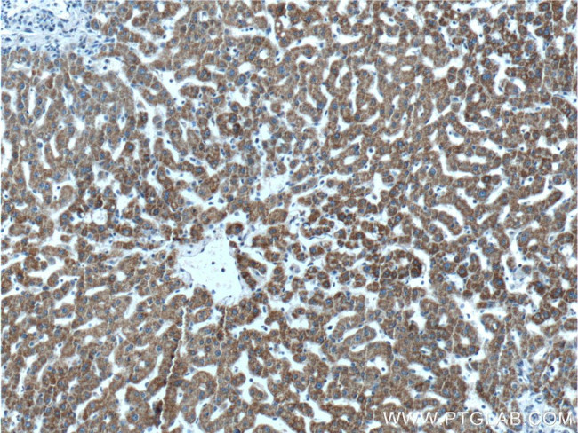 GCDH Antibody in Immunohistochemistry (Paraffin) (IHC (P))