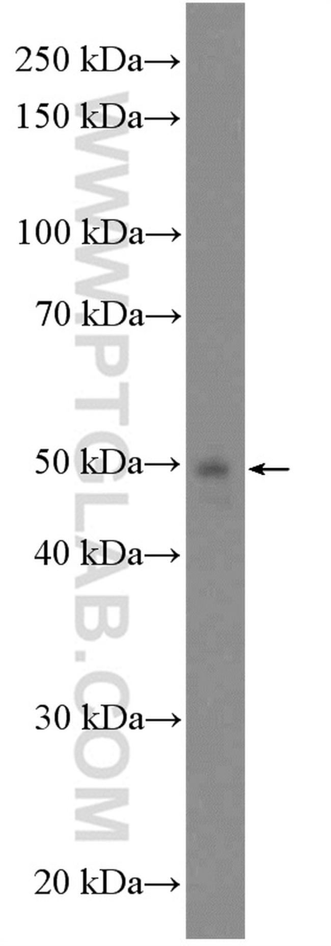 GCDH Antibody in Western Blot (WB)