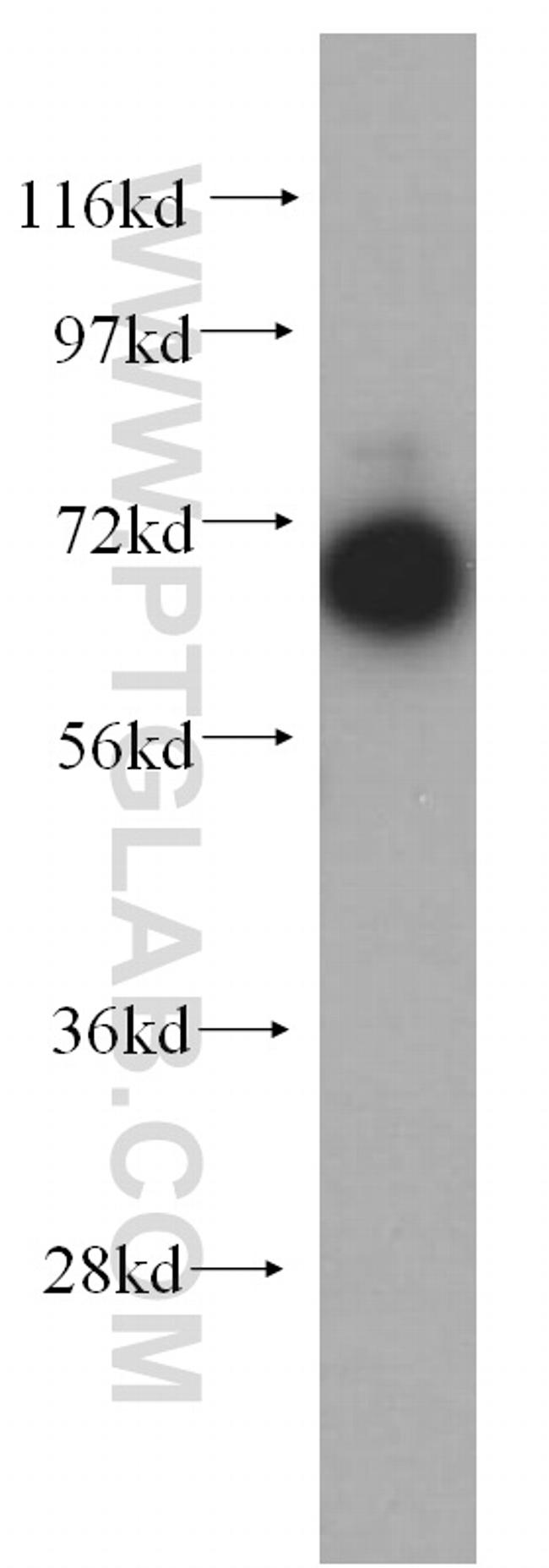 GNPAT Antibody in Western Blot (WB)