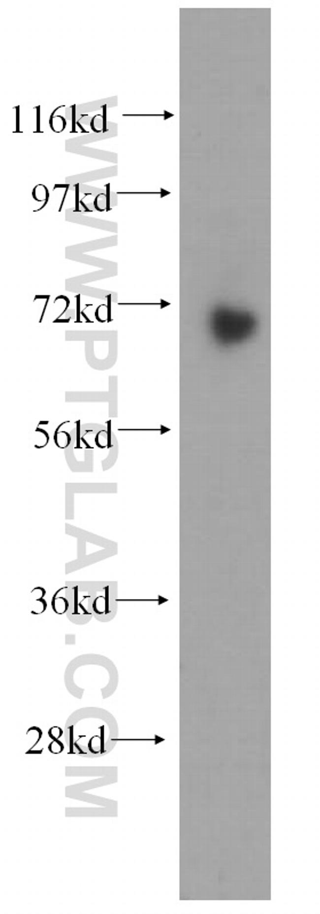 GNPAT Antibody in Western Blot (WB)