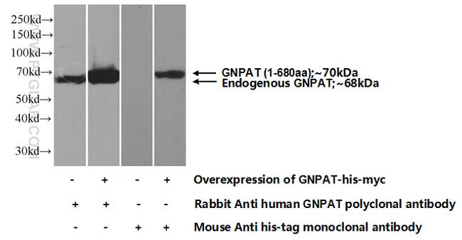 GNPAT Antibody in Western Blot (WB)