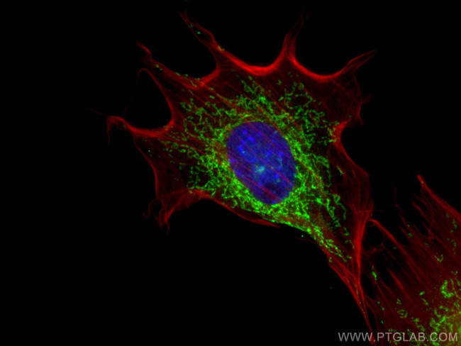 MECR Antibody in Immunocytochemistry (ICC/IF)