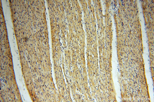 MECR Antibody in Immunohistochemistry (Paraffin) (IHC (P))