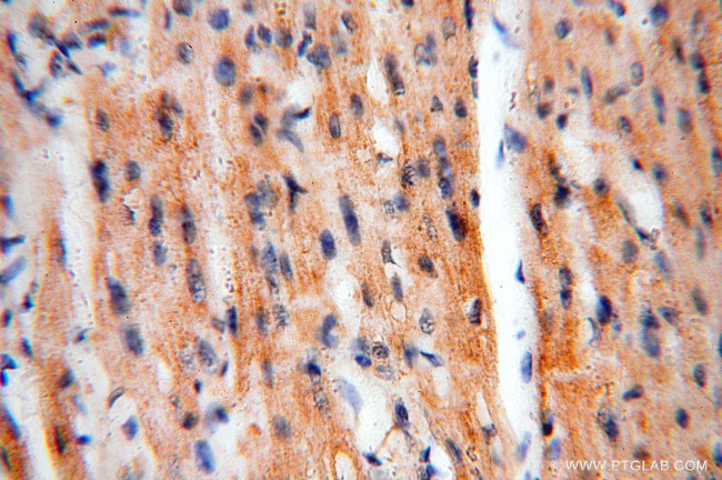 MECR Antibody in Immunohistochemistry (Paraffin) (IHC (P))