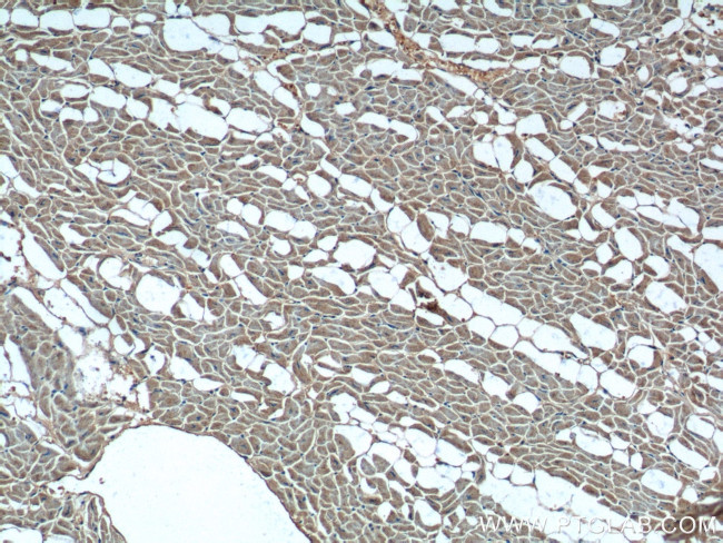 MECR Antibody in Immunohistochemistry (Paraffin) (IHC (P))