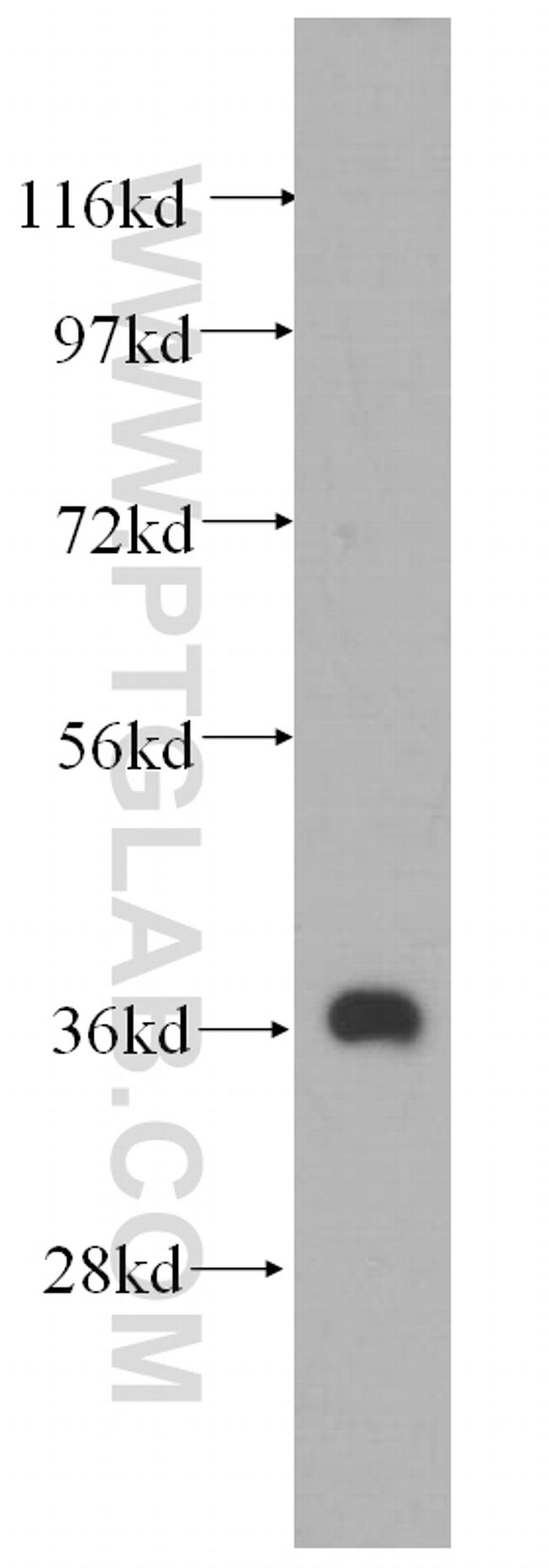 MECR Antibody in Western Blot (WB)