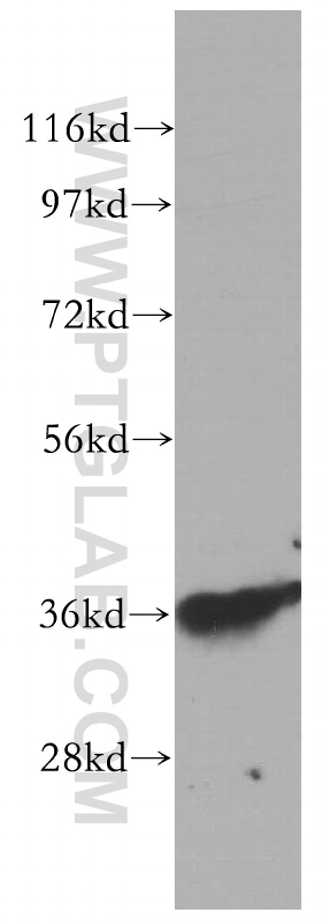 MECR Antibody in Western Blot (WB)