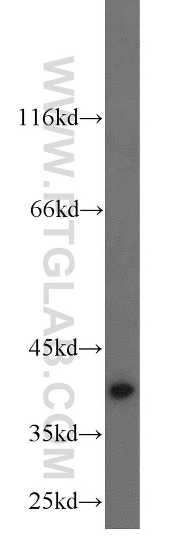 URAT1 Antibody in Western Blot (WB)