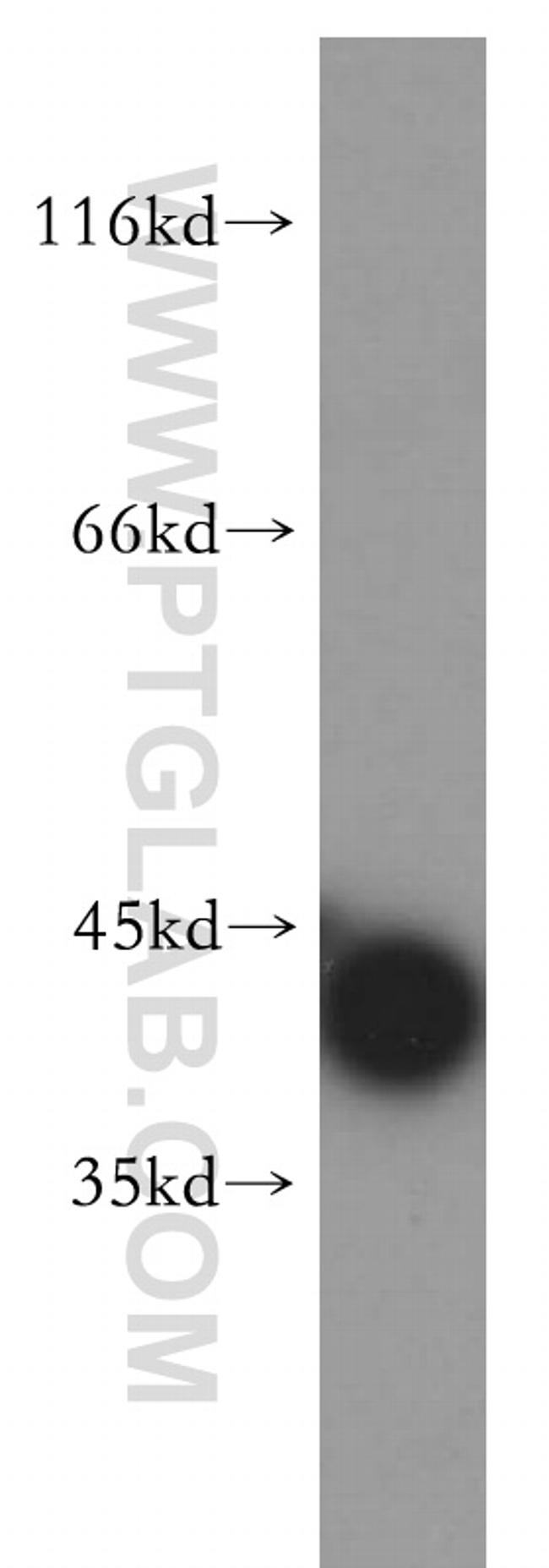 URAT1 Antibody in Western Blot (WB)