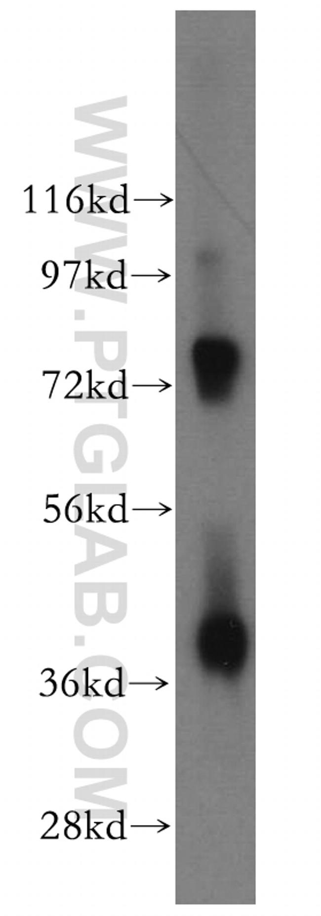 DNMT3L Antibody in Western Blot (WB)