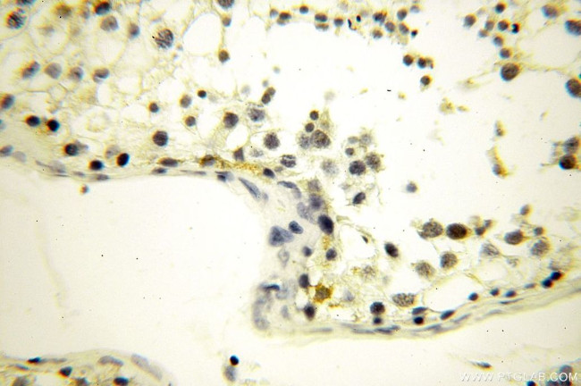 GGPS1 Antibody in Immunohistochemistry (Paraffin) (IHC (P))