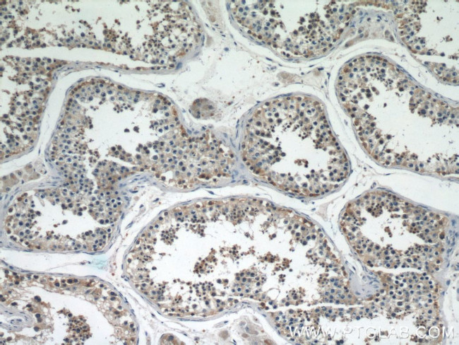 GGPS1 Antibody in Immunohistochemistry (Paraffin) (IHC (P))