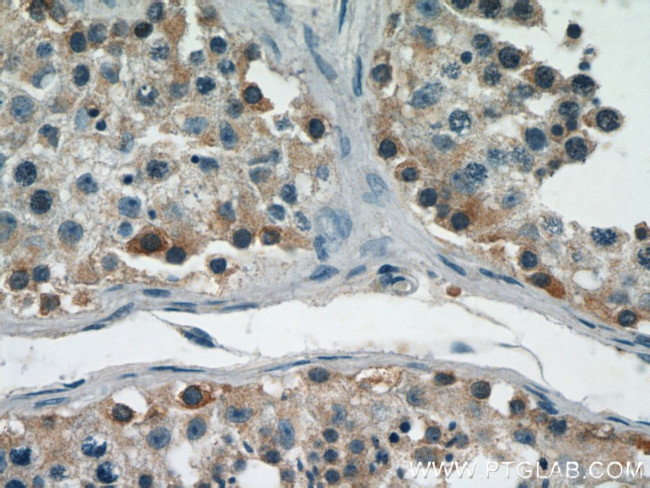 GGPS1 Antibody in Immunohistochemistry (Paraffin) (IHC (P))