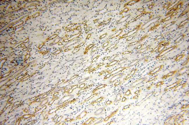 GGPS1 Antibody in Immunohistochemistry (Paraffin) (IHC (P))