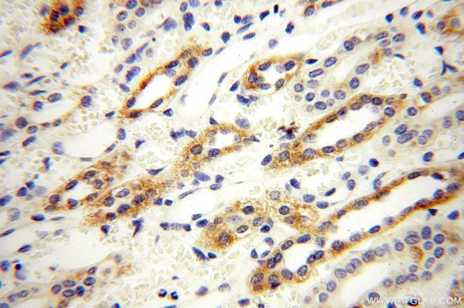 GGPS1 Antibody in Immunohistochemistry (Paraffin) (IHC (P))