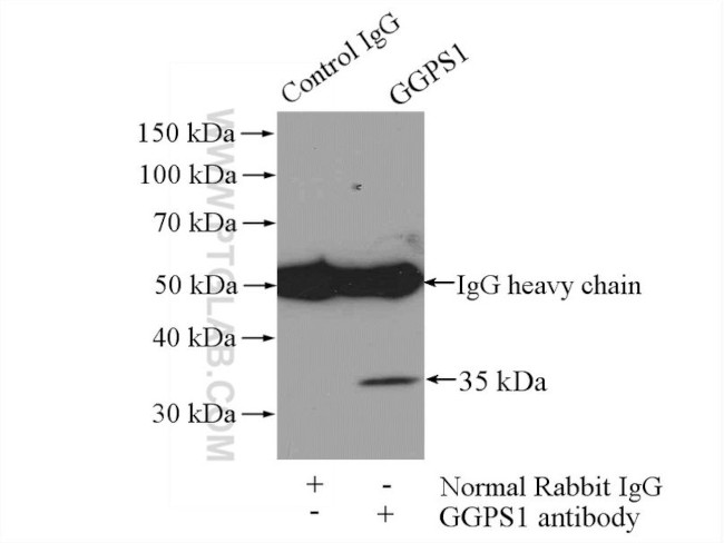 GGPS1 Antibody in Immunoprecipitation (IP)