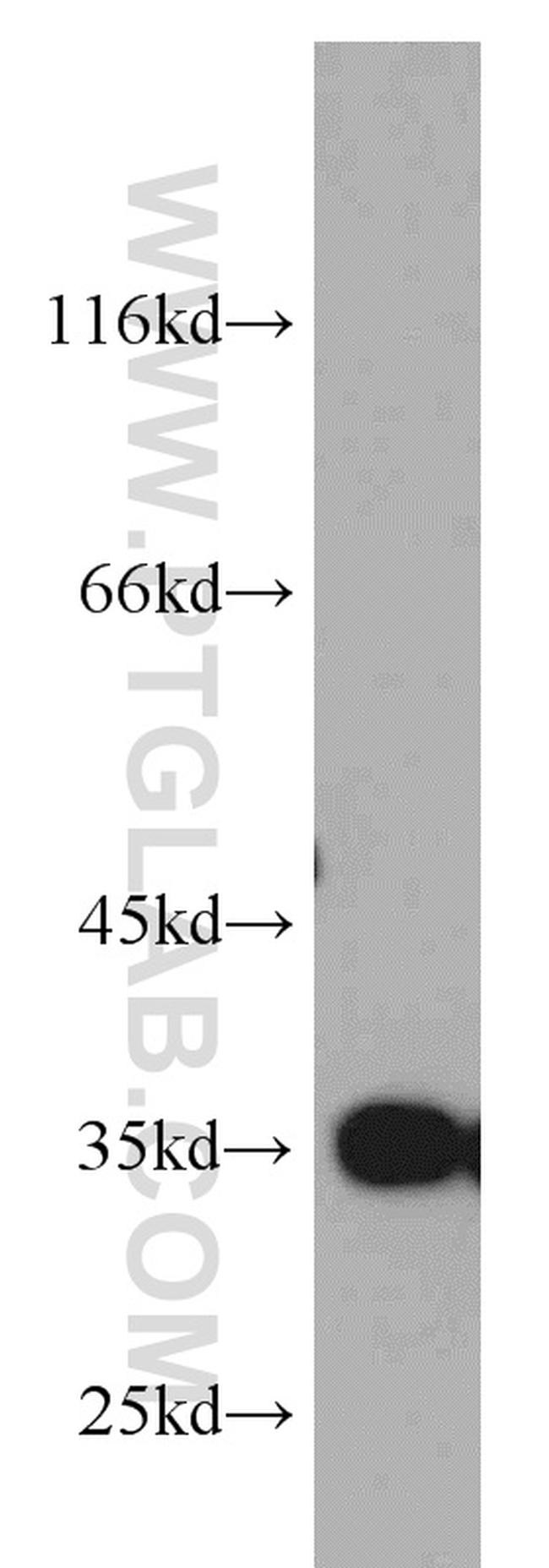 GGPS1 Antibody in Western Blot (WB)