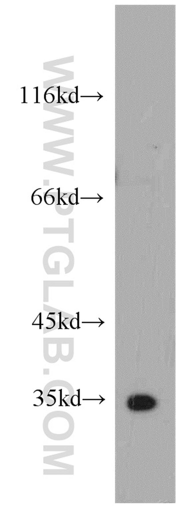 GGPS1 Antibody in Western Blot (WB)