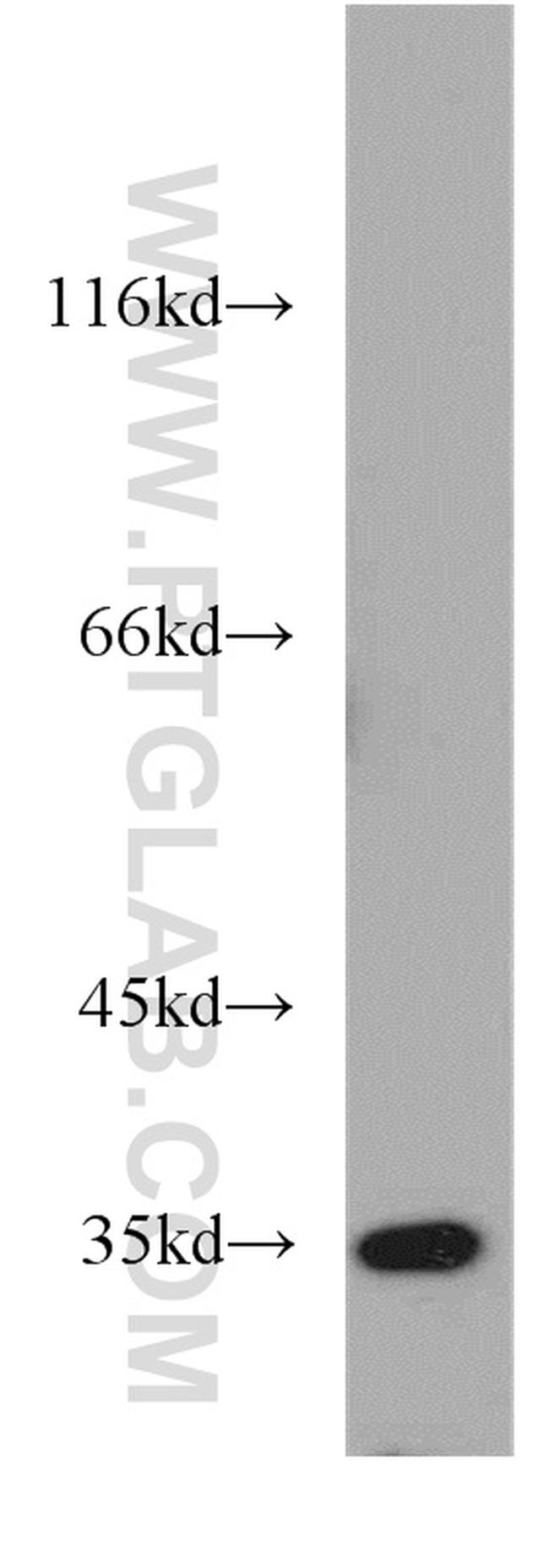 GGPS1 Antibody in Western Blot (WB)