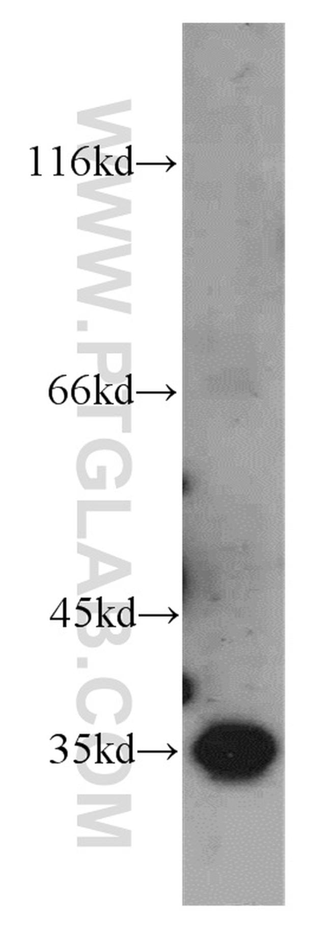 GGPS1 Antibody in Western Blot (WB)