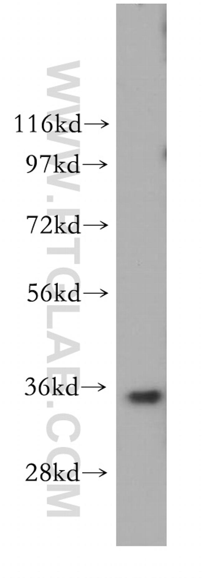 GGPS1 Antibody in Western Blot (WB)