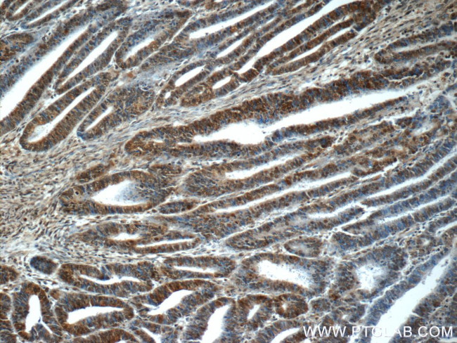 RPS27A Antibody in Immunohistochemistry (Paraffin) (IHC (P))