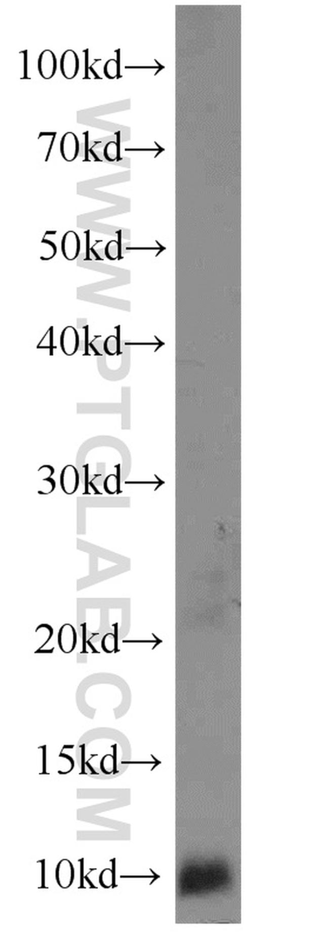 RPS27A Antibody in Western Blot (WB)