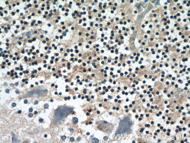 RPS27A Antibody in Immunohistochemistry (Paraffin) (IHC (P))