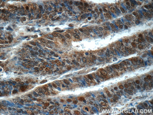 RPS27A Antibody in Immunohistochemistry (Paraffin) (IHC (P))