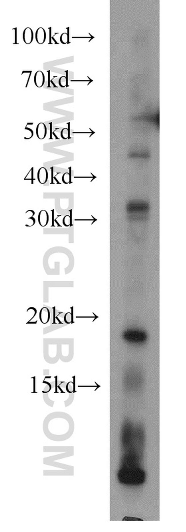 RPS27A Antibody in Western Blot (WB)