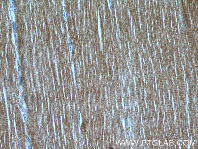 LMOD3 Antibody in Immunohistochemistry (Paraffin) (IHC (P))