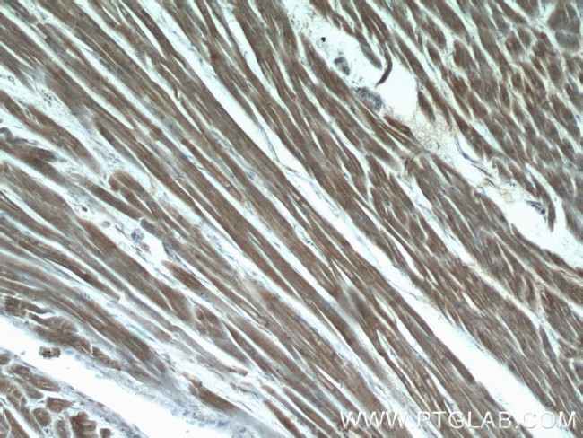 LMOD3 Antibody in Immunohistochemistry (Paraffin) (IHC (P))