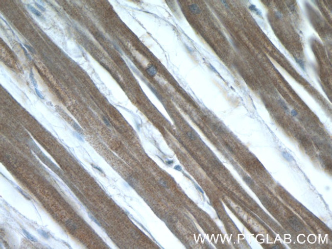 LMOD3 Antibody in Immunohistochemistry (Paraffin) (IHC (P))