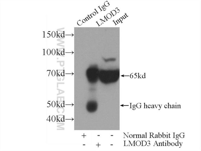 LMOD3 Antibody in Immunoprecipitation (IP)