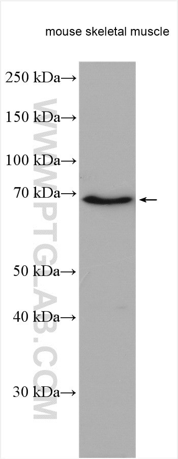 LMOD3 Antibody in Western Blot (WB)