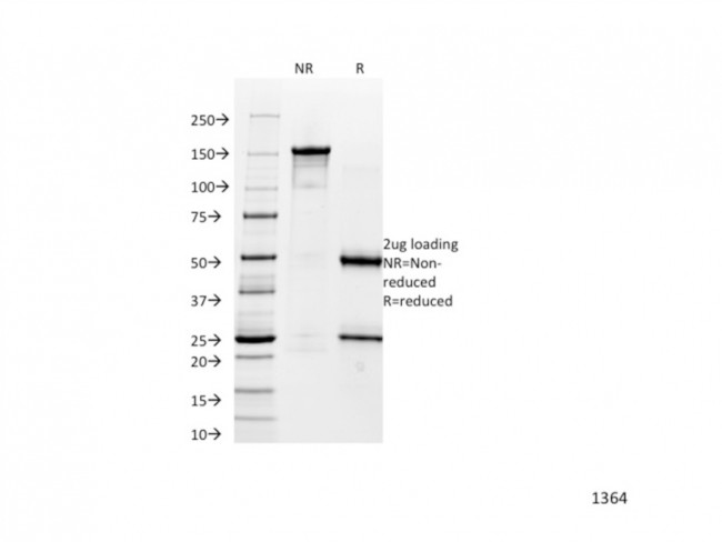 Catenin, alpha-1 (CTNNA1) Antibody in SDS-PAGE (SDS-PAGE)