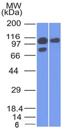 Catenin, alpha-1 (CTNNA1) Antibody in Western Blot (WB)
