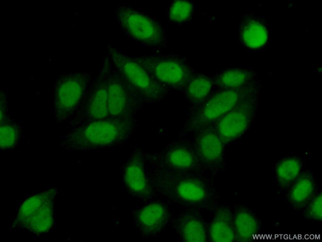 SNIP1 Antibody in Immunocytochemistry (ICC/IF)