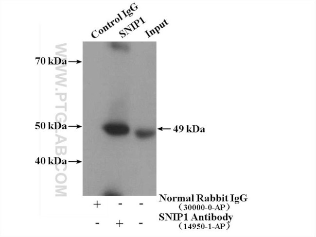 SNIP1 Antibody in Immunoprecipitation (IP)