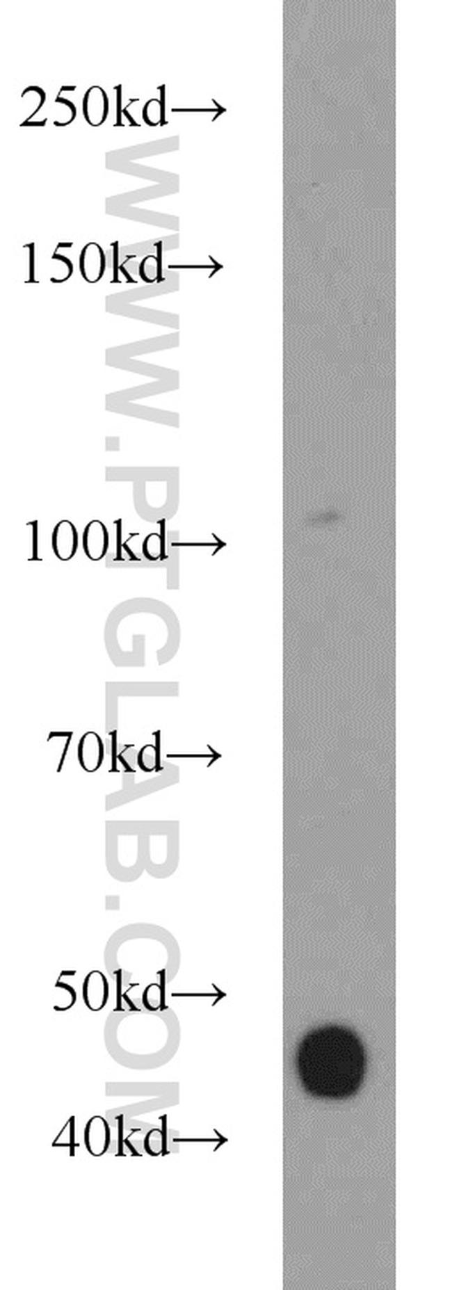 SNIP1 Antibody in Western Blot (WB)