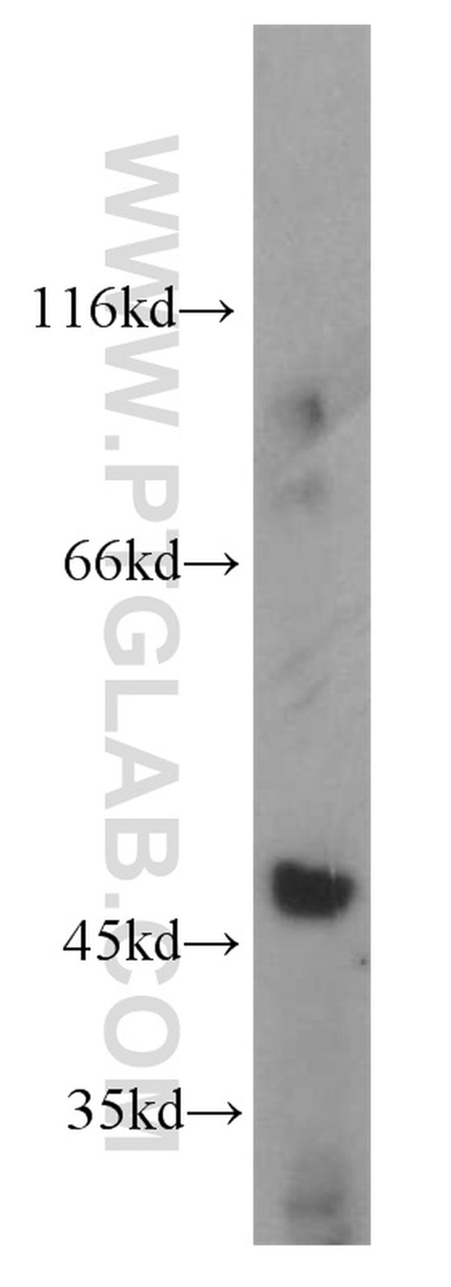 SNIP1 Antibody in Western Blot (WB)