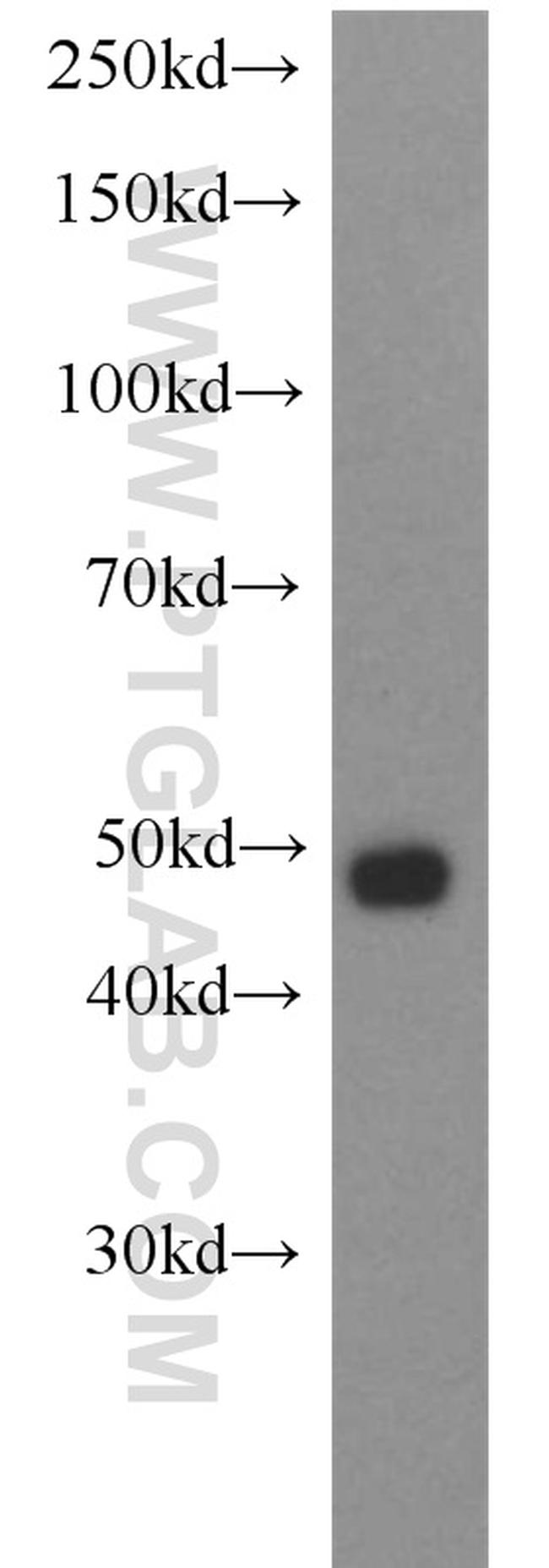 SNIP1 Antibody in Western Blot (WB)