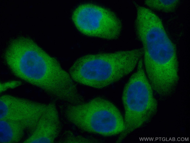 KARS Antibody in Immunocytochemistry (ICC/IF)