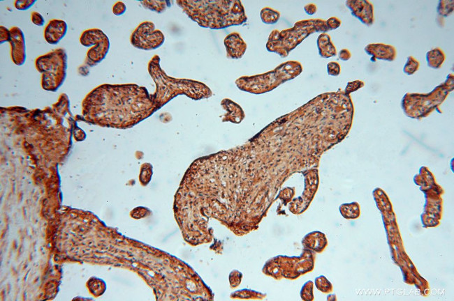 KARS Antibody in Immunohistochemistry (Paraffin) (IHC (P))