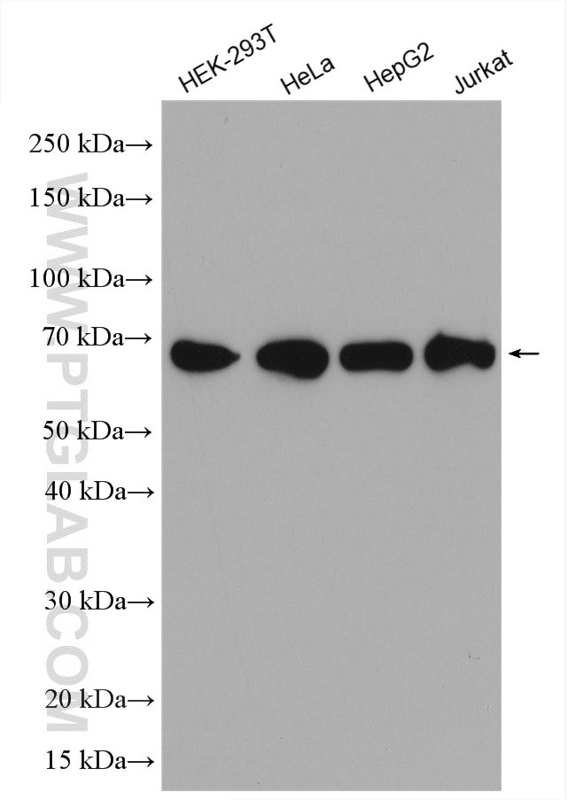 KARS Antibody in Western Blot (WB)