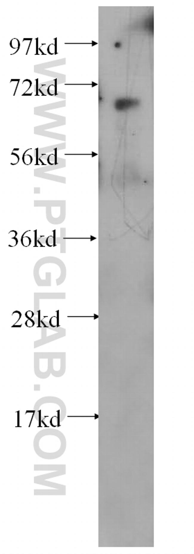 KARS Antibody in Western Blot (WB)