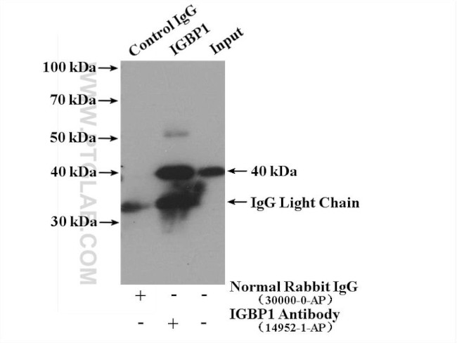 IGBP1 Antibody in Immunoprecipitation (IP)