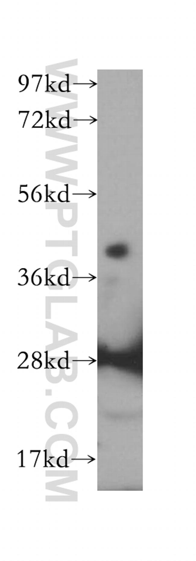 IGBP1 Antibody in Western Blot (WB)