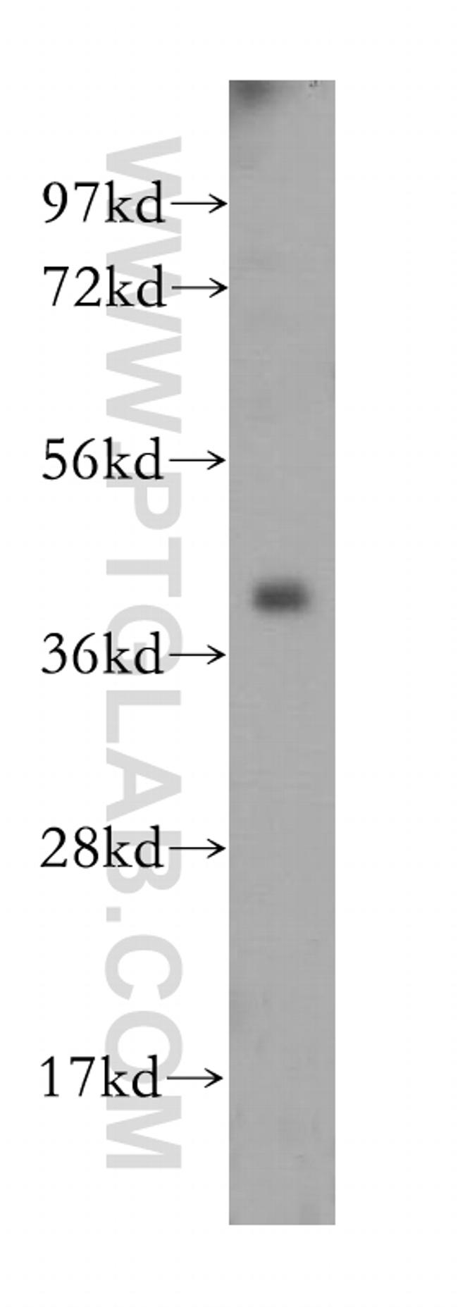 IGBP1 Antibody in Western Blot (WB)